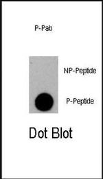 Phospho-eIF4E (Ser209) Antibody in Dot Blot (DB)