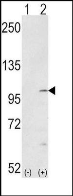 Phospho-FGFR (Tyr653, Tyr654) Antibody in Western Blot (WB)