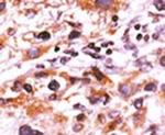 Phospho-FGFR1 (Tyr766) Antibody in Immunohistochemistry (IHC)