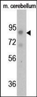 Phospho-FGFR1 (Tyr766) Antibody in Western Blot (WB)