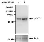 Phospho-GIT1 (Tyr554) Polyclonal Antibody