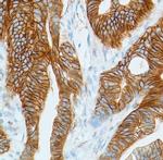 Phospho-Girdin (Tyr1765) Antibody in Immunohistochemistry (IHC)