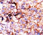 Phospho-Histone H3 (Ser10) Antibody in Immunohistochemistry (IHC)
