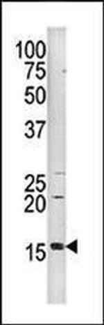 Phospho-Histone H3 (Ser10) Antibody in Western Blot (WB)