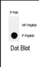 Phospho-HIPK2 (Tyr361) Antibody in Dot Blot (DB)