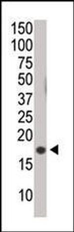 Phospho-Histone H3 (Ser10) Antibody in Western Blot (WB)