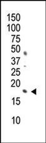 Phospho-Histone H3 (Ser10) Antibody in Western Blot (WB)