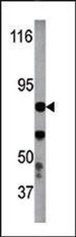 Phospho-IKK beta (Tyr199) Antibody in Western Blot (WB)