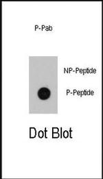 Phospho-ILK (Ser246) Antibody in Dot Blot (DB)