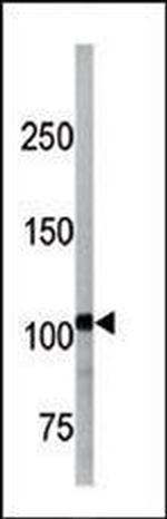 Phospho-LLGL2 (Ser649, pS653) Antibody in Western Blot (WB)