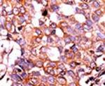 Phospho-LRP1 (Ser4520) Antibody in Immunohistochemistry (IHC)