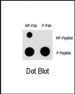 Phospho-MEF2C (Ser396) Antibody in Dot Blot (DB)