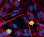 Phospho-MEK1 (Thr286) Antibody in Immunocytochemistry (ICC/IF)