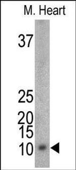 Phospho-FXYD1 (Ser88) Antibody in Western Blot (WB)