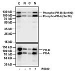 Phospho-Progesterone Receptor (Ser190) Antibody in Western Blot (WB)
