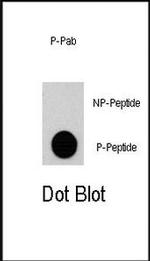 Phospho-RSK2 (Ser369) Antibody in Dot Blot (DB)