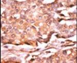 Phospho-RAD9 (Ser272) Antibody in Immunohistochemistry (IHC)