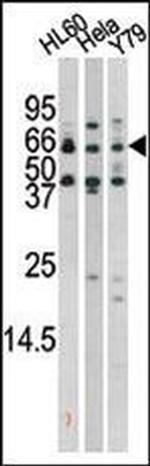 Phospho-RAD9 (Ser272) Antibody in Western Blot (WB)