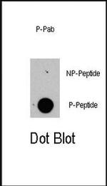 Phospho-Raptor (Ser863) Antibody in Dot Blot (DB)
