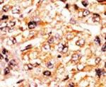 Phospho-RBL1 (Ser975) Antibody in Immunohistochemistry (IHC)