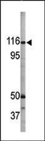 Phospho-RBL1 (Ser975) Antibody in Western Blot (WB)