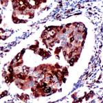 Phospho-S6 (Ser235, Ser236) Antibody in Immunohistochemistry (IHC)