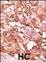 Phospho-STAT5 alpha (Ser726) Antibody in Immunohistochemistry (IHC)