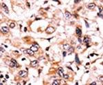 Phospho-WEE1 (Ser123) Antibody in Immunohistochemistry (IHC)