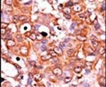 Phospho-Wee1 (Ser53) Antibody in Immunohistochemistry (IHC)