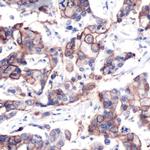 Phospho-ErbB2 (HER-2) (Tyr1248) Antibody in Immunohistochemistry (IHC)