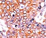 Phospho-p16INK4a (Ser152) Antibody in Immunohistochemistry (IHC)