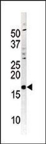 Phospho-p16INK4a (Ser152) Antibody in Western Blot (WB)