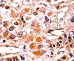 Phospho-p16INK4a (Ser7) Antibody in Immunohistochemistry (IHC)