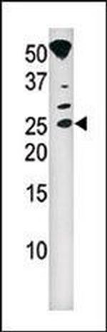 Phospho-p16INK4a (Ser7) Antibody in Western Blot (WB)