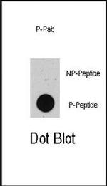 Phospho-p53 (Thr55) Antibody in Dot Blot (DB)