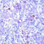 Phosphotyrosine Antibody in Immunohistochemistry (IHC)