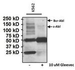 Phosphotyrosine Antibody in Western Blot (WB)