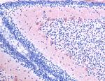 Pleiotrophin Antibody in Immunohistochemistry (IHC)
