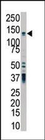 PKD2 Antibody in Western Blot (WB)