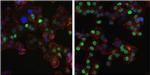 Progesterone Receptor Antibody in Immunocytochemistry (ICC/IF)
