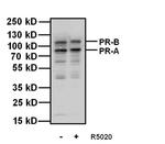 Progesterone Receptor Antibody in Western Blot (WB)