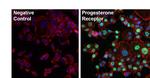 Progesterone Receptor Antibody in Immunocytochemistry (ICC/IF)