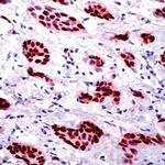 Progesterone Receptor Antibody in Immunohistochemistry (IHC)