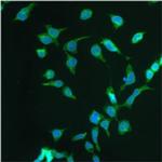 Progestin Receptor beta Antibody in Immunocytochemistry (ICC/IF)