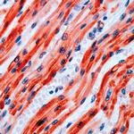 PAR4 Antibody in Immunohistochemistry (IHC)