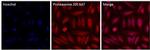 PSMB6 Antibody in Immunocytochemistry (ICC/IF)