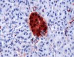 PGP9.5 Antibody in Immunohistochemistry (IHC)