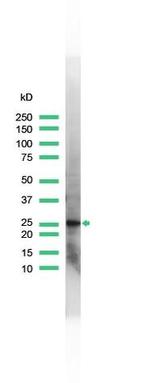 PGP9.5 Antibody in Western Blot (WB)