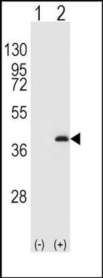 PP1 beta Antibody in Western Blot (WB)