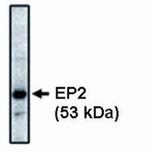 PTGER2 Monoclonal Antibody (3E6)